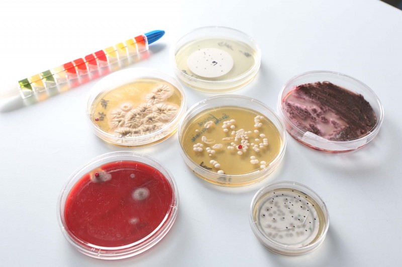 Microbiologie alimentaire